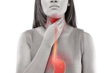 Miệng và vòm họng có thể bị dịch vị dạ dày trào ngược tấn công gây ra các triệu chứng hôi và viêm đau