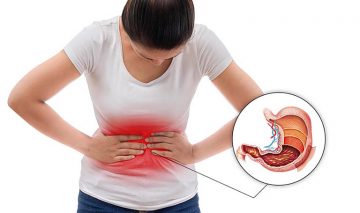 Khi bị nhiễm HP, người bệnh thường có biểu hiện đau bụng, khó chịu