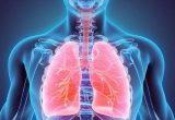 Viêm phế quản phổi: Bệnh nguy hiểm cần điều trị sớm