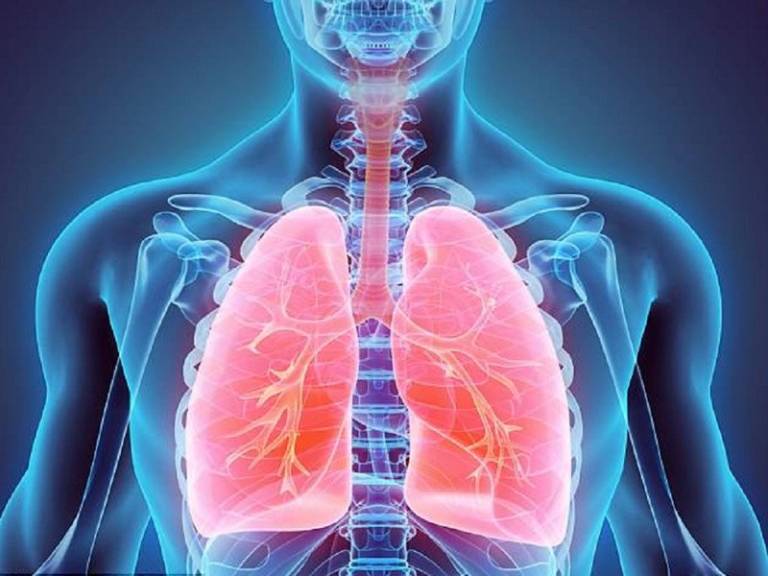 Viêm phế quản phổi: Bệnh nguy hiểm cần điều trị sớm