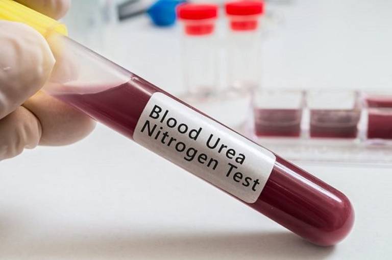 Xét nghiệm sinh hoá máu