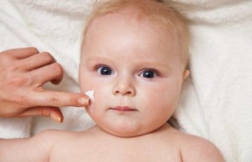 Một số lưu ý khi dùng kem trị hắc lào cho bé