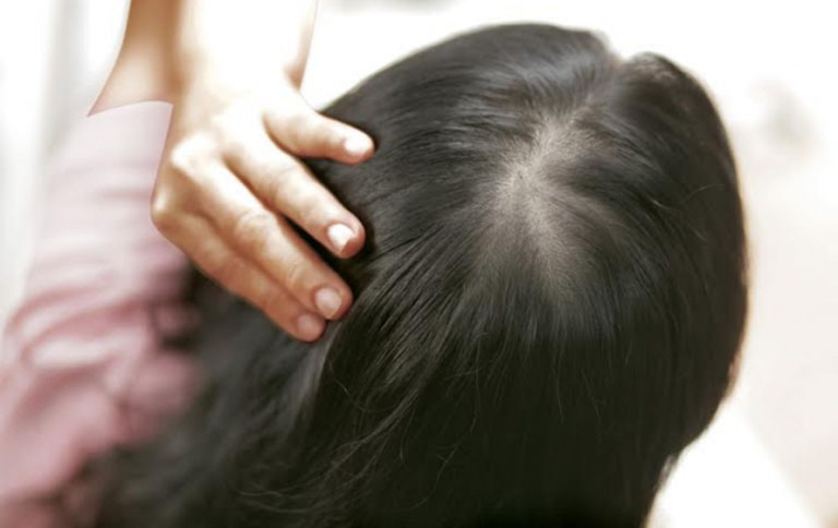 Chăm sóc và phòng ngừa viêm nang lông da đầu tái phát