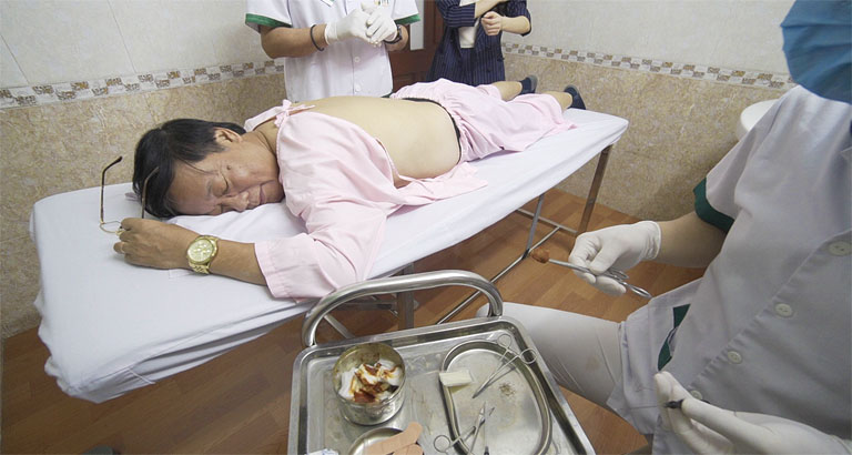 Nghệ sĩ Phú Thăng chữa đau lưng do thoát vị đĩa đệm L4, L5 tại Đông Phương Y Pháp