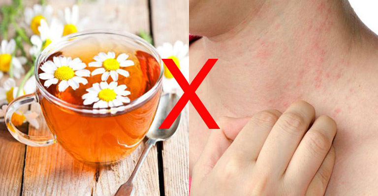 Loại trà hoa này có thể gây dị ứng da và viêm da nhạy cảm