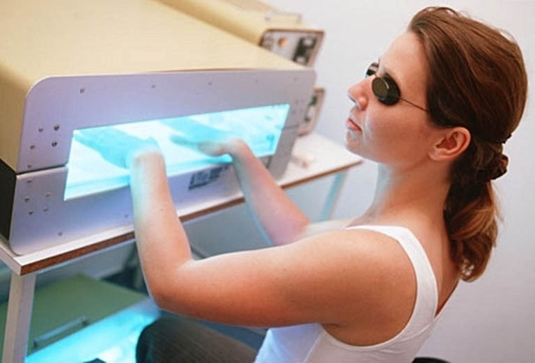 Phương pháp điều trị bằng ánh sáng tia UV được áp dụng cho bệnh nhân tổ đỉa