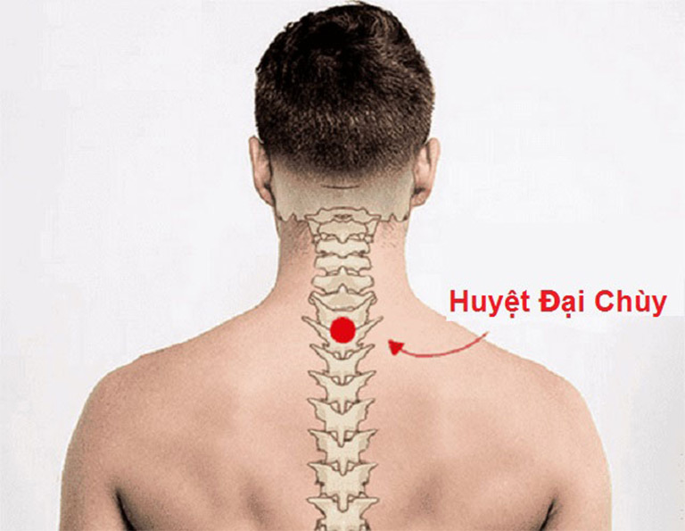 Huyệt Đại Chùy có liên quan mật thiết đến cơ xương khớp vùng cổ - vai - gáy