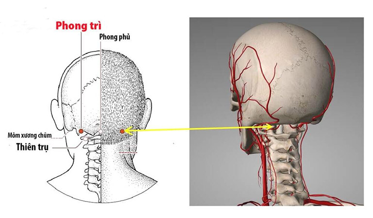 Huyệt Phong Trì (ký hiệu GB20) là huyệt đạo rất quan trọng trên cơ thể