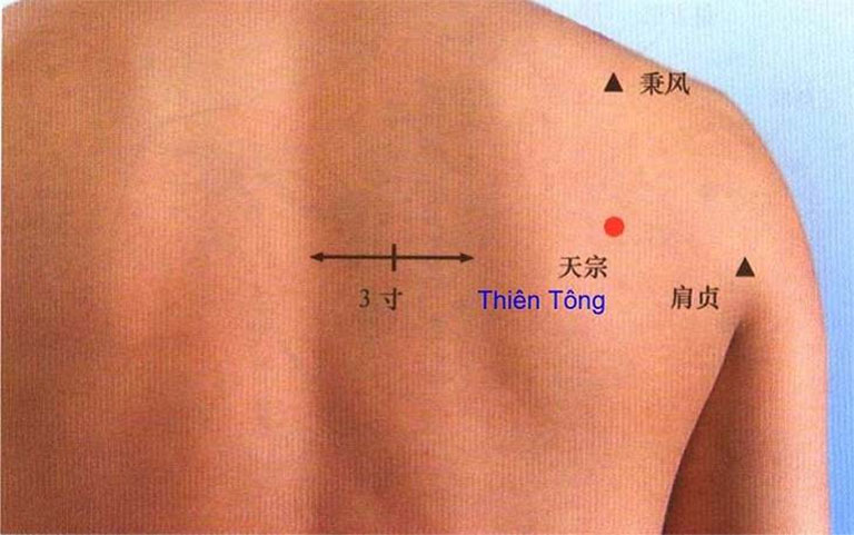 Huyệt Thiên Tông chủ trị chứng bệnh đau bả vai, cánh tay