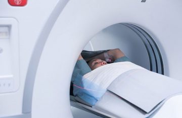 Xét nghiệm hình ảnh (chụp X quang, MRI)