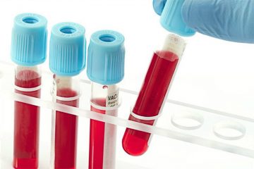 Xét nghiệm tế bào máu ngoại vi và sinh hóa