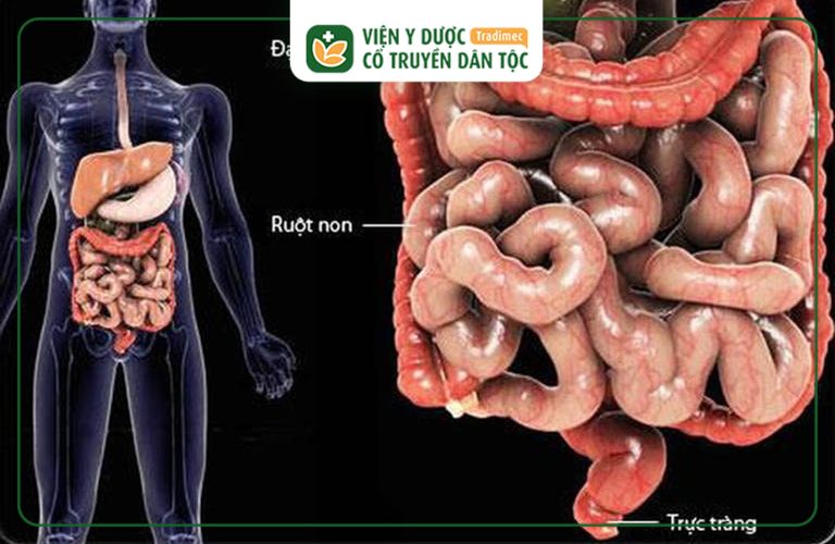 Phân biệt viêm dạ dày và hội chứng ruột kích thích